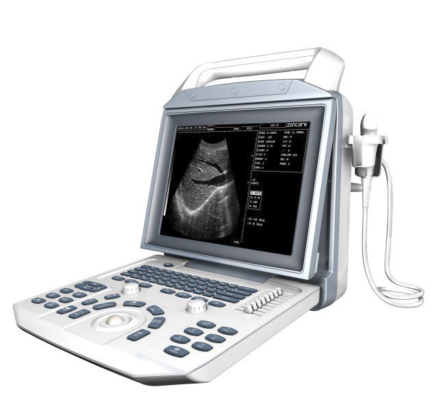 i50 zoncare ultrasound